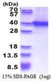 Human CRALBP protein, His tag. GTX67751-pro