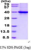 Human CRALBP protein, His tag. GTX67752-pro