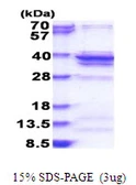 Human RPL5 protein, His tag. GTX67756-pro