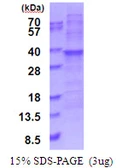 Human RPL7A protein, His tag. GTX67757-pro
