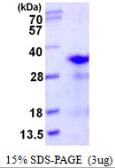 Human RPL8 protein, His tag. GTX67758-pro