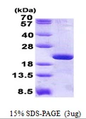 Human RPL12 protein, His tag. GTX67760-pro