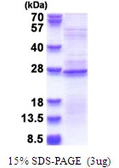 Human RPL18A protein, His tag. GTX67761-pro