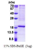 Human RPL22 protein, His tag. GTX67762-pro