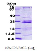 Human RPL23A protein, His tag. GTX67763-pro