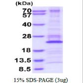 Human RPL26 protein, His tag. GTX67764-pro