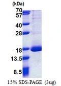 Human RPL30 protein, His tag. GTX67765-pro