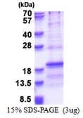 Human RPL31 protein, His tag. GTX67766-pro
