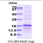 Human RPL34 protein, His tag. GTX67767-pro