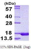 Human RPLP2 protein, His tag. GTX67769-pro