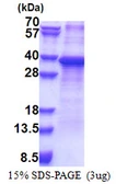Human RPS2 protein, His tag. GTX67770-pro