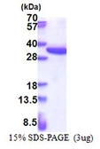 Human RPS4X protein, His tag. GTX67773-pro