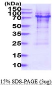 Human p70 S6K protein, His tag. GTX67775-pro