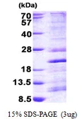 Human RPS13 protein, His tag. GTX67779-pro
