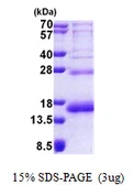 Human RPS19 protein, His tag. GTX67783-pro