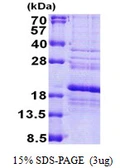 Human RPS24 protein, His tag. GTX67785-pro