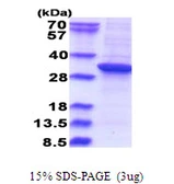 Human RSU1 protein, His tag. GTX67787-pro