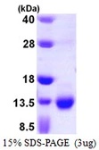 Human S100A3 protein, His tag. GTX67788-pro