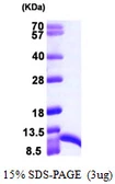 Human S100A6 protein, His tag. GTX67791-pro