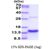 Human Psoriasin protein, His tag. GTX67792-pro