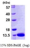Human S100A13 protein, His tag. GTX67798-pro