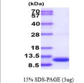 Human S100 beta protein, His tag. GTX67799-pro