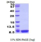 Human S100 beta protein. GTX67800-pro