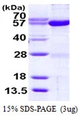 Human Seryl-tRNA synthetase protein, His tag. GTX67803-pro