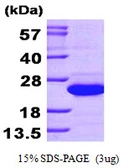 Human SAT1 protein, His tag. GTX67804-pro