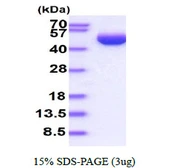 Human SerpinB3 protein, His tag. GTX67805-pro