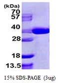Human SEC13L1 protein, His tag. GTX67808-pro