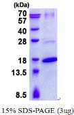 Human TRAPPC2 protein, His tag. GTX67809-pro