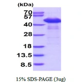 Human SET protein, His tag. GTX67811-pro
