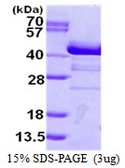 Human SH3GL2 protein, His tag. GTX67816-pro