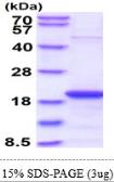 Human SKP1 protein. GTX67821-pro