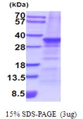 Human SLUG protein, His tag. GTX67822-pro