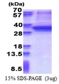 Human SNAI1 protein, His tag. GTX67824-pro