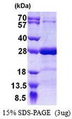 Human SNAP25 protein, His tag. GTX67825-pro