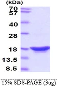 Human beta Synuclein protein. GTX67828-pro