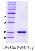 Human gamma Synuclein protein. GTX67835-pro