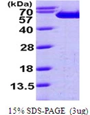 Human Fascin 1 protein, His tag. GTX67836-pro