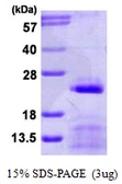 Human SNRPC protein, His tag. GTX67839-pro