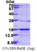Human SNRPD3 protein, His tag. GTX67841-pro