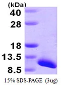 Human SNRPG protein, His tag. GTX67844-pro