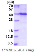 Human PU.1 protein, His tag. GTX67846-pro
