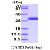Human SPR protein, His tag. GTX67847-pro