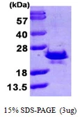 Human Sorcin protein, His tag. GTX67848-pro
