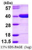 Human AKR1D1 protein, His tag. GTX67849-pro