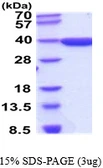Human AKR1D1 protein. GTX67850-pro
