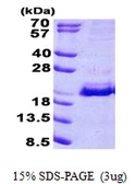 Human SRP19 protein, His tag. GTX67853-pro